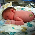 First_day_in_NICU